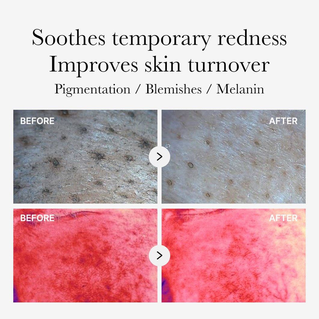Red Succinic Acid Panthenol Pads
